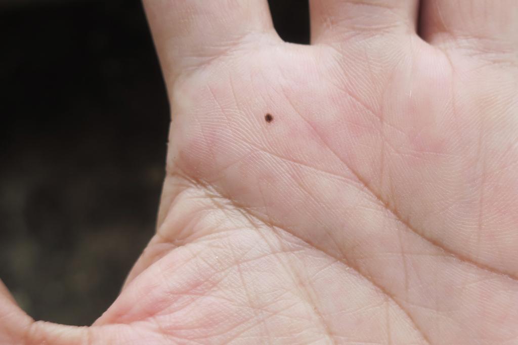 手上8痣帶好運！長在上手臂貴人運超強 不愁沒人愛 其他 旺得富理財網