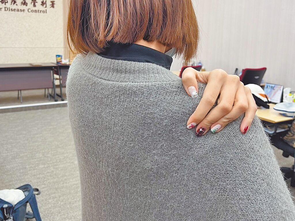 肩頸痛誤診竟為皮蛇——帶狀皰疹案例解析